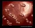 corynebacterium diphtheriae